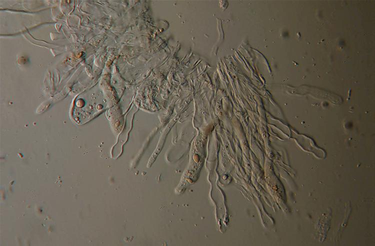 Aleurodiscus amorphus (Fr.)Schroeter